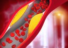 High cholesterol: The skin on this part of the body has become dry? Understand the increased cholesterol level