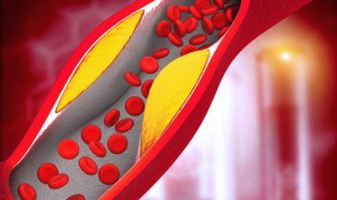High cholesterol: The skin on this part of the body has become dry? Understand the increased cholesterol level