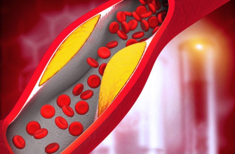 High cholesterol: The skin on this part of the body has become dry? Understand the increased cholesterol level